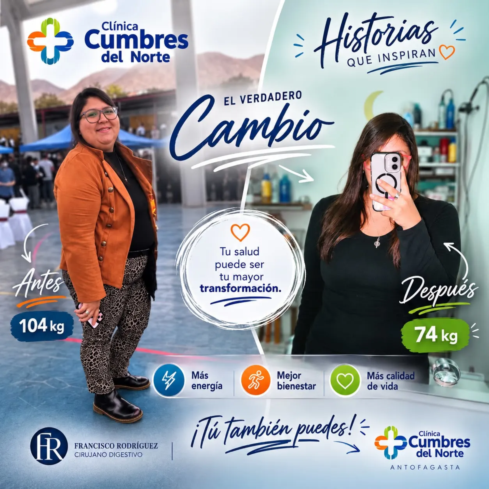 historia real de una paciente de cirugia bariatrica